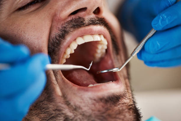 Best Walk-In Emergency Dentist in Rogers, MN